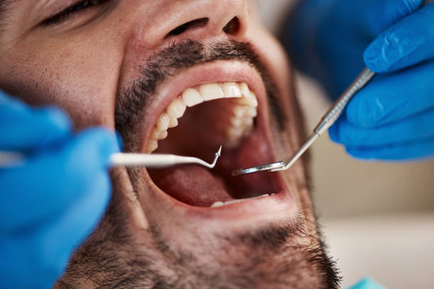 Best Weekend Emergency Dentist in Collinsville, VA